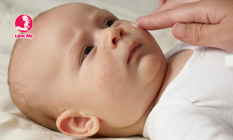 Cách chăm sóc da mặt cho bé mẹ đã biết chưa?